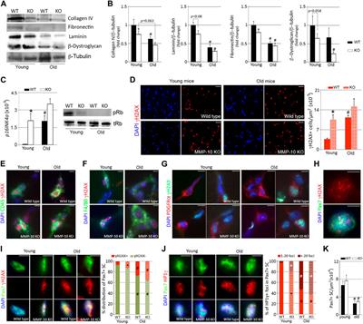 Loss of the matrix metalloproteinase-10 causes premature features of aging in satellite cells